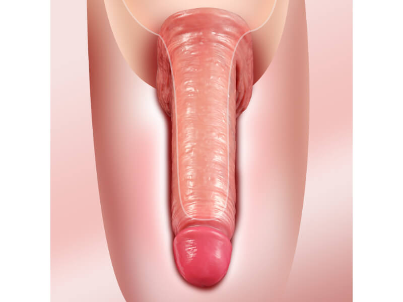 3 Size Realistic Penis Sleeve Penis Extender